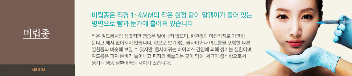 비립종은 직경 1~4mm의 작은 흰점 같이 알갱이가 들어 있는 병변으로 뺨과 눈가에 흩어져 있습니다. 작은 여드름처럼 생겼지만 염증은 일어나지 않으며, 한관종과 마찬가지로 가만히 둔다고 해서 없어지지 않습니다. 겉으로 보기에는 물사마귀나 여드름을 포함한 다른 질환들과 비슷해 보일 수 있지만, 물사마귀는 바이러스 감염에 의해 생기는 질환이며, 여드름은 피지 분비가 늘어나고 피지의 배출되는 곳이 막혀, 세균이 증식함으로서 생기는 염증 질환이라는 차이가 있습니다. 