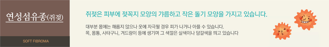 쥐젖은 피부에 젖꼭지 모양의 갸름하고 작은 돌기 모양을 가지고 있습니다. 대부분 몸에는 해롭지 않으나 옷에 자극될 경우 피가 나거나 아플 수 있습니다. 목, 몸통, 사타구니, 겨드랑이 등에 생기며 그 색깔은 살색이나 담갈색을 띄고 있습니다 